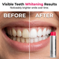 🥳2026 HOT SALE🥳💞 50K+ VERKOCHT! 😁✨ 50% KORTING! Vlekverwijderende Whitening Mondspoeling – Verwijdert koffie- en theevlekken, alcoholvrij. Bindt vuil direct, langdurig frisse muntsmaak. Zacht genoeg voor dagelijks gebruik. 🦷💙