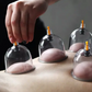 ⏳Time-Limited Special⏰Vacuum Cupping Therapy Set – Thickened, Suction Pump, Transparent 🩺