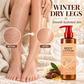 🌿✨ Van droge plekken naar zijdezachte huid – deze lotion met shea butter en jojoba-olie geeft intensieve hydratatie en trekt razendsnel in. 50% KORTING!